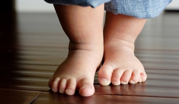Làm sao để nhận biết dấu hiệu bàn chân bẹt ở trẻ nhỏ?